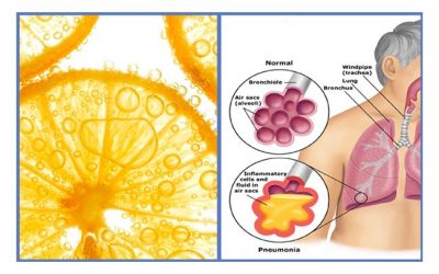 Vitamin C deficiency linked to pneumonia in three separate trials