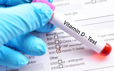 Study links Vitamin D deficiency to 54% higher SARS-CoV-2 positivity rate